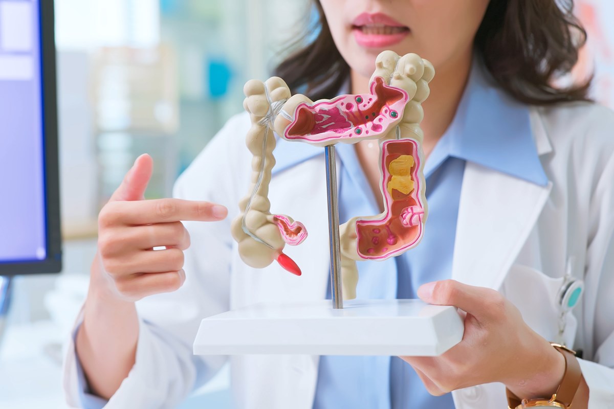 Câncer de intestino em jovens: estudo aponta as principais causas