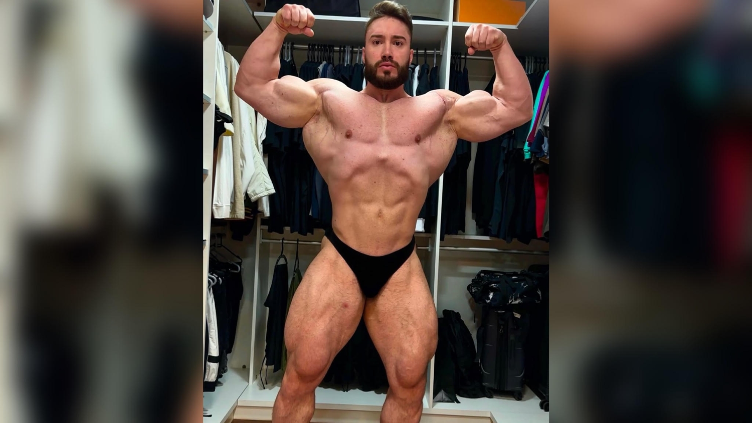 Vídeo: fisiculturista revela sangramento bizarro antes do Mr. Olympia