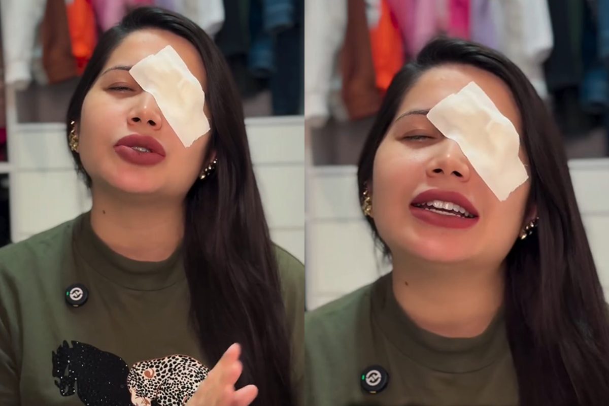 Influencer tem hemorragia ocular após usar lentes vencidas em trend
