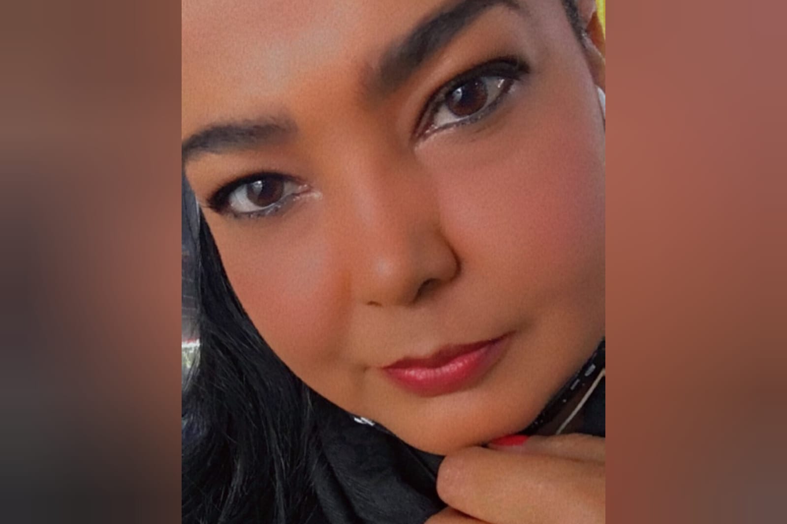 Aos 35 anos, mulher tem 2 AVCs e descobre malformação cardíaca