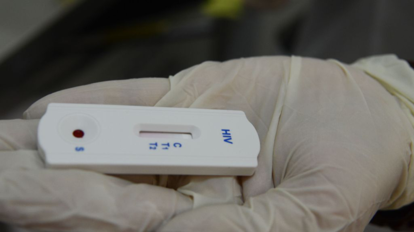 Cientistas criam nanopartículas e avançam no tratamento do HIV