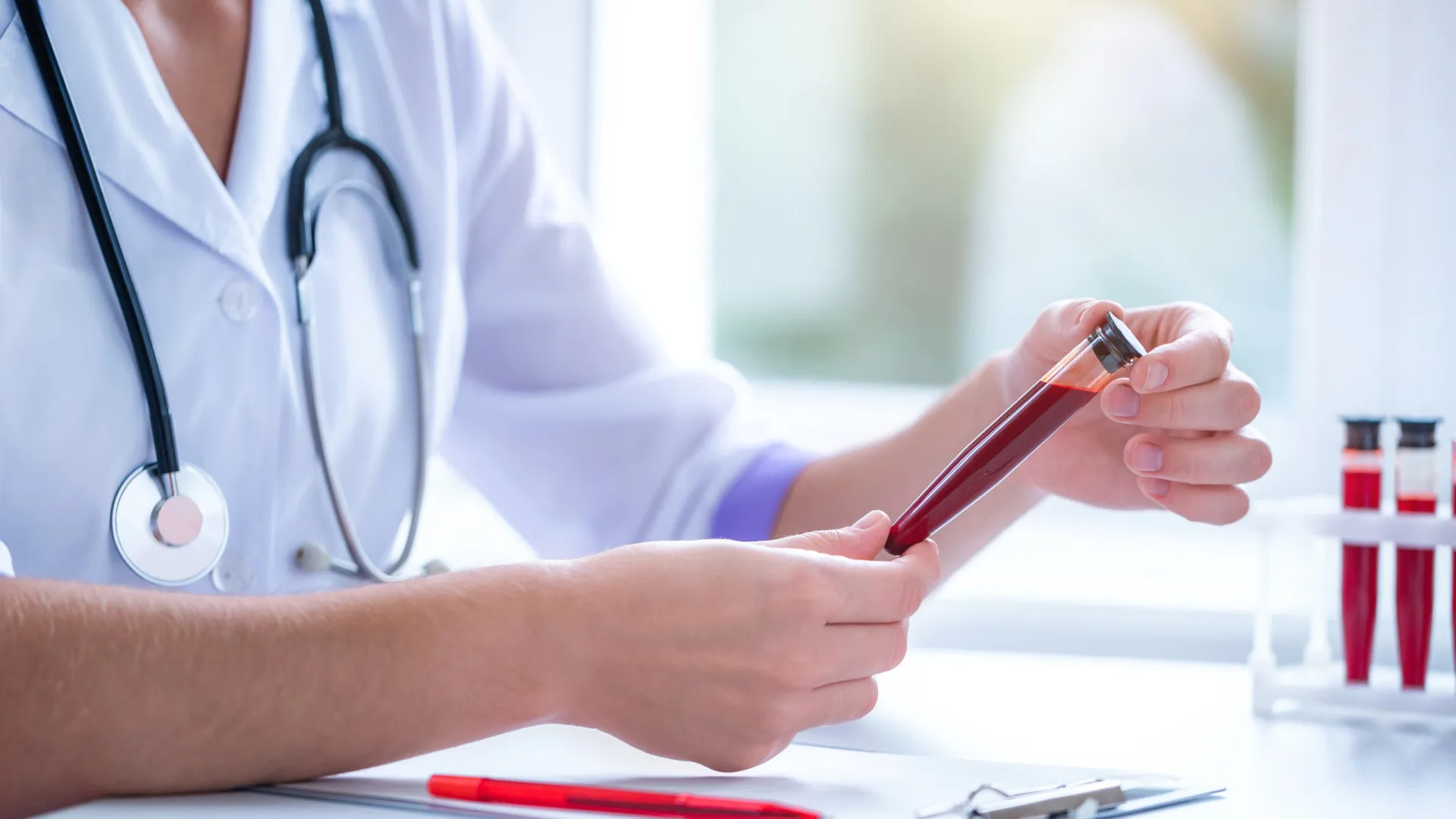 Os tipos de sangue que podem aumentar o risco de câncer do pâncreas