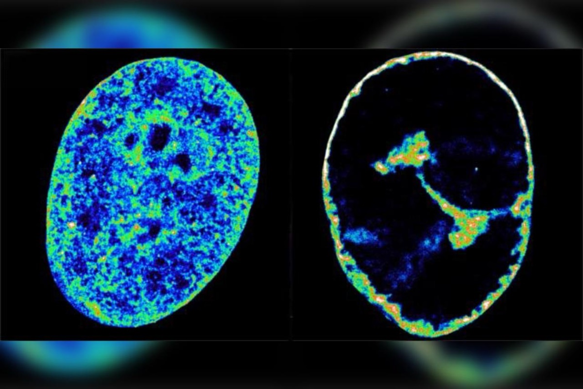 Imagens mostram como o vírus da herpes altera as células humanas