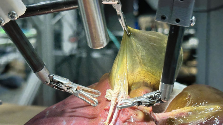 Robô realiza cirurgia sem intervenção humana nos EUA