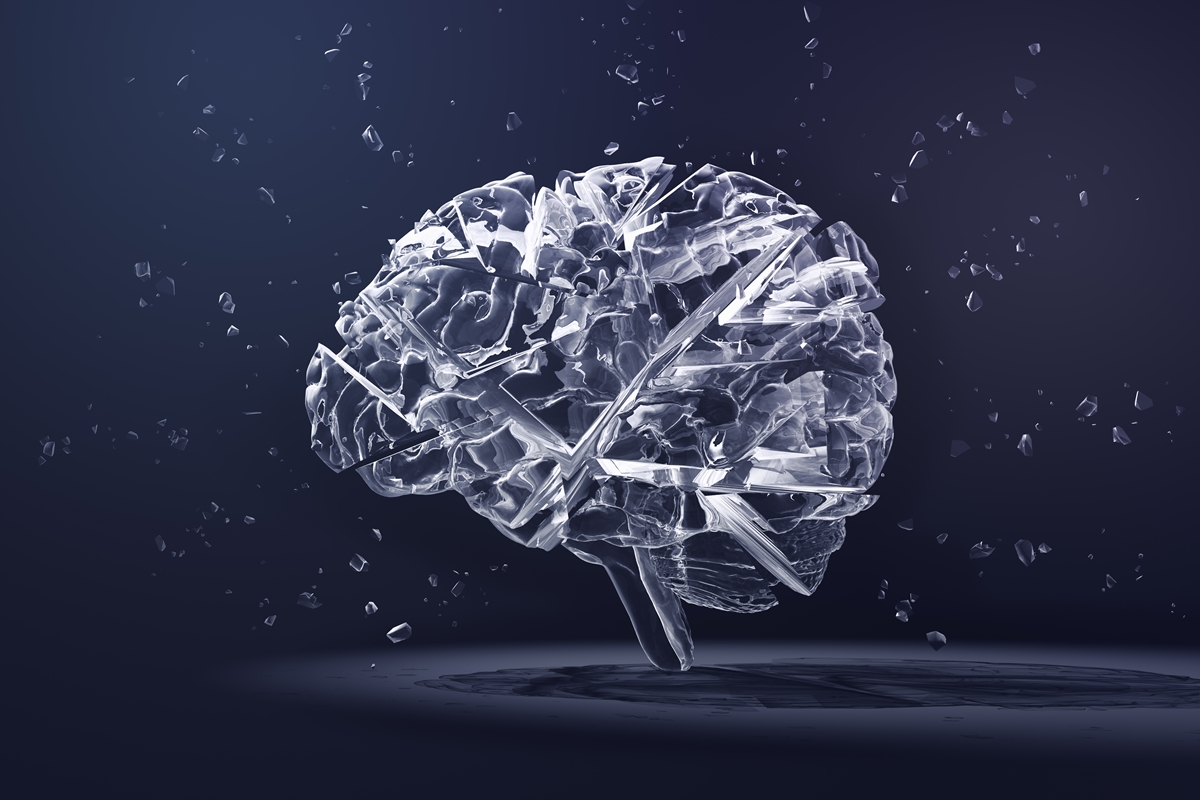 Tumor cerebral: veja 4 sinais que o corpo dá e você não deve ignorar