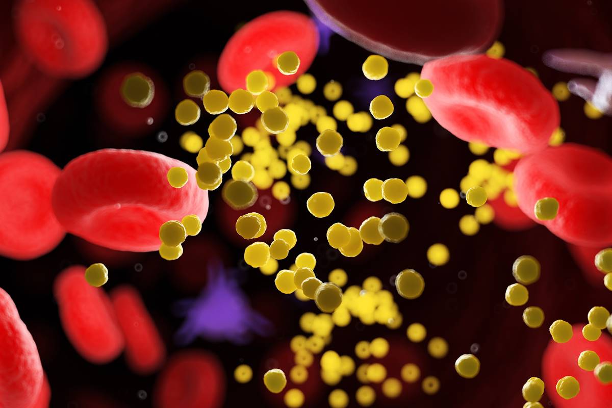 Conheça os riscos da lipoproteína (a), novo tipo de colesterol