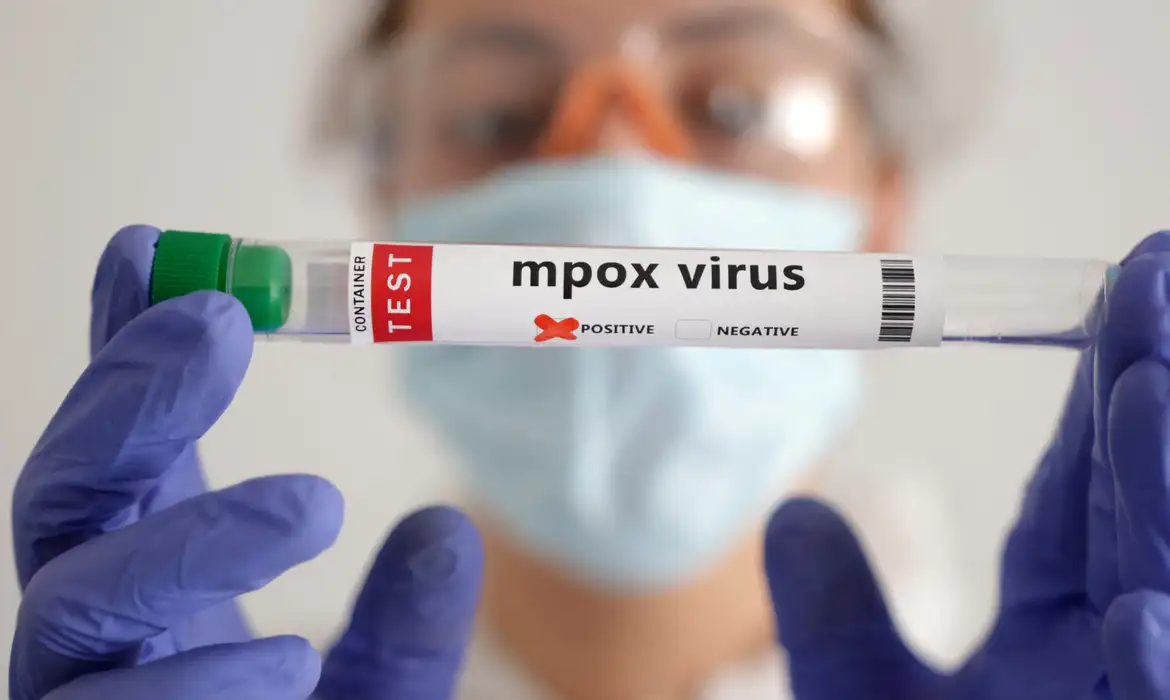Mpox: África tem quase 50 mil casos confirmados
