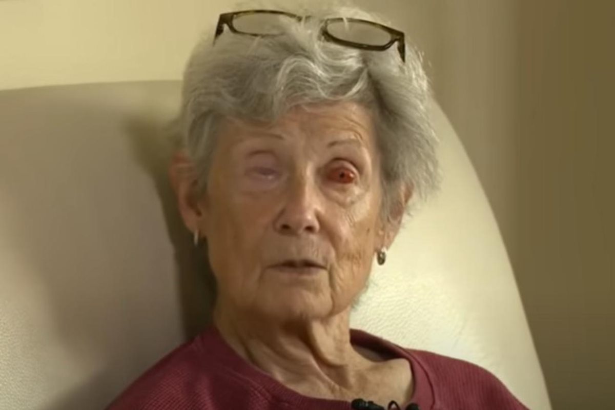 Mulher recupera visão após cirurgia com implante de dente no olho