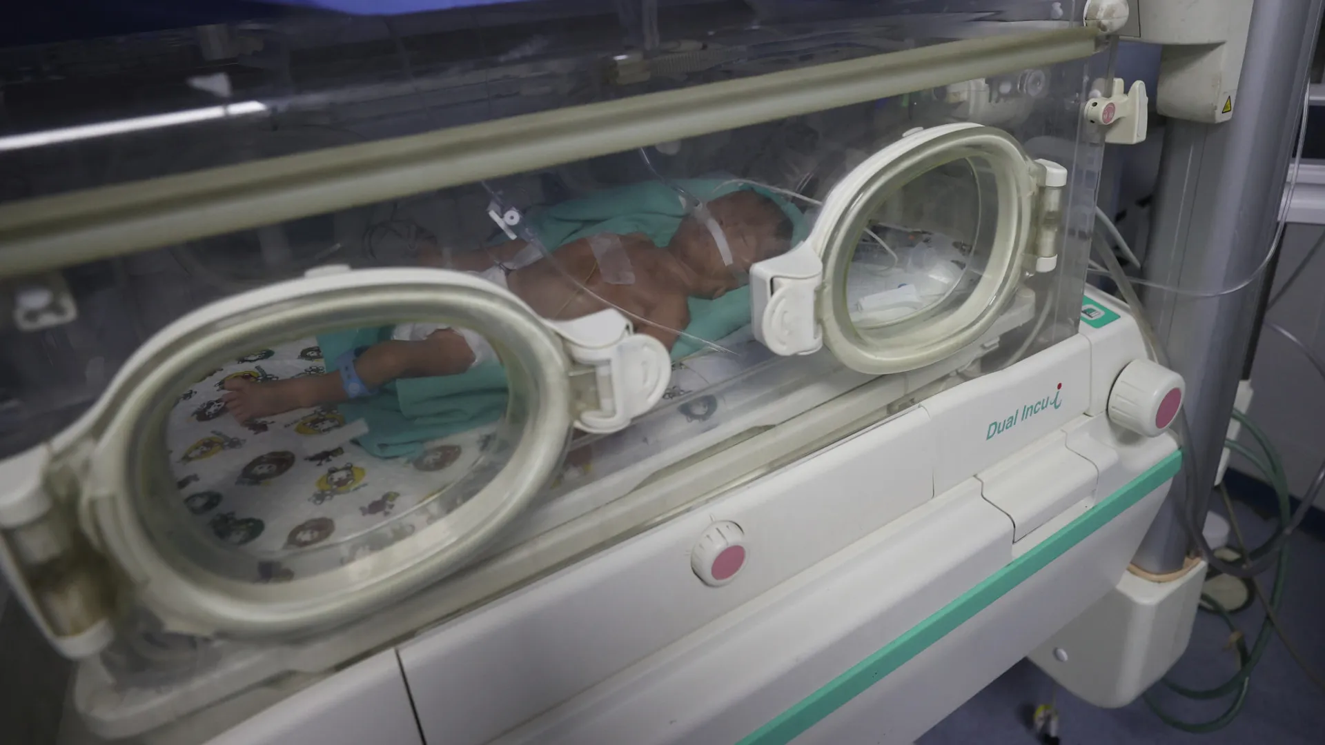 Itália apura se detergente contaminado causou mortes de bebês prematuros