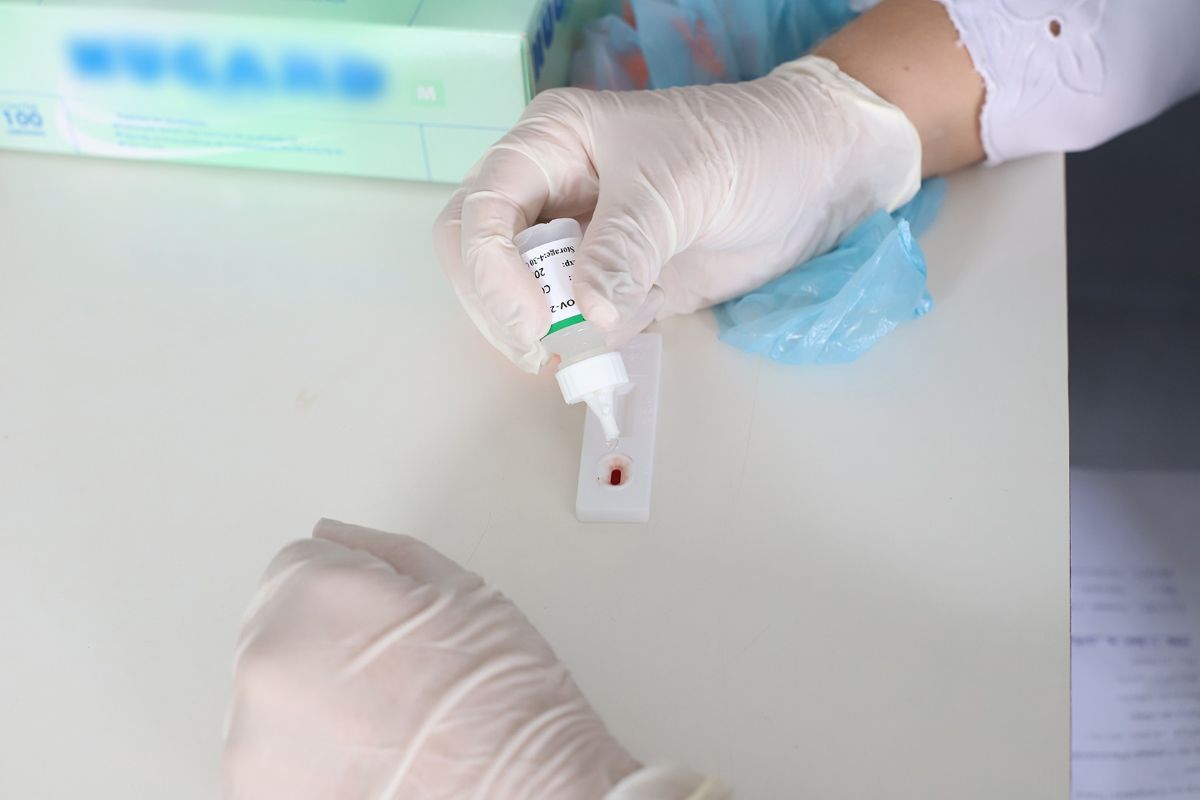 Paciente de SP fica 17 meses curado do HIV com tratamento experimental