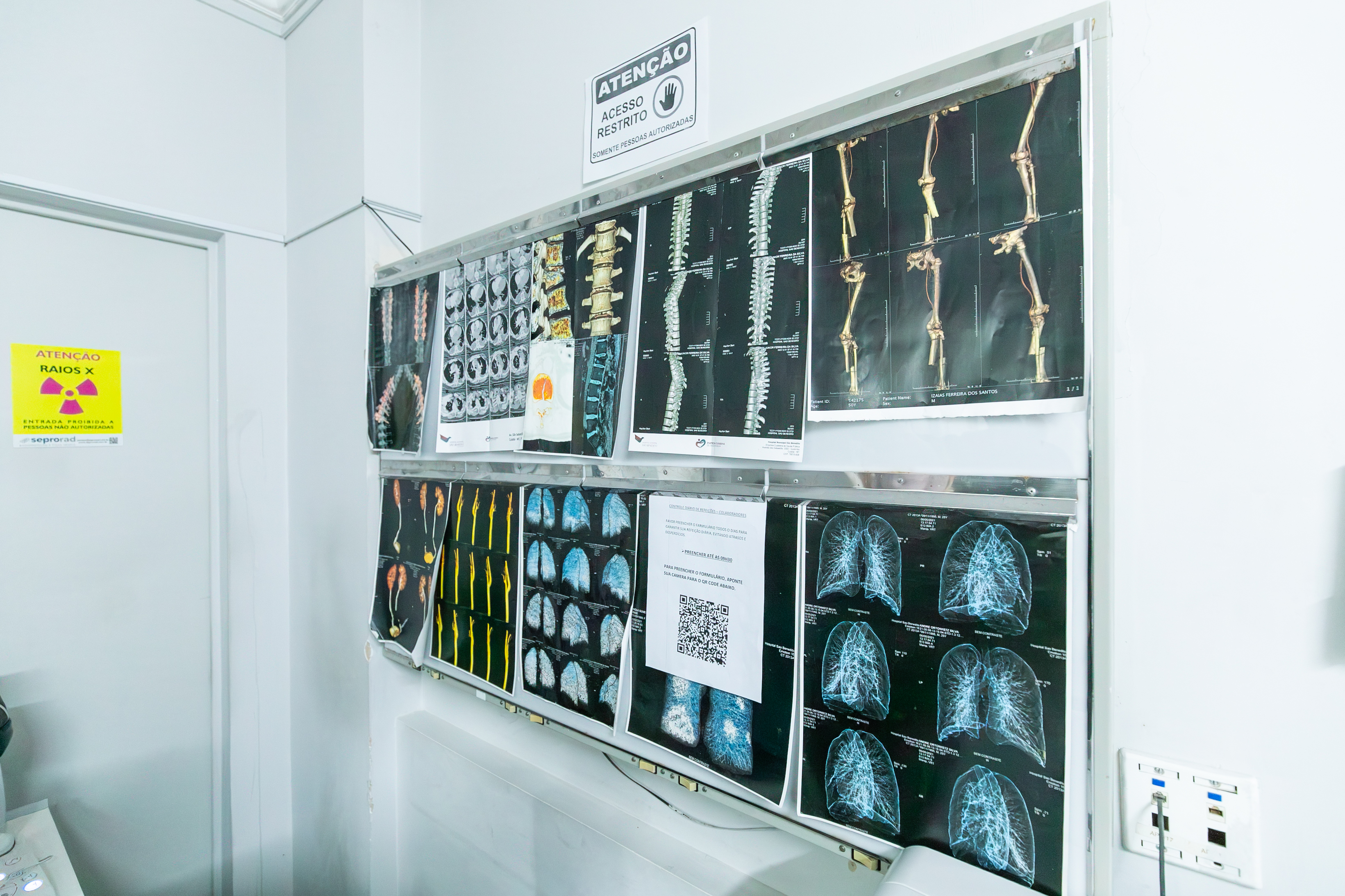 Saúde de Cuiabá já oferece mamografia e ressonância para mulheres 