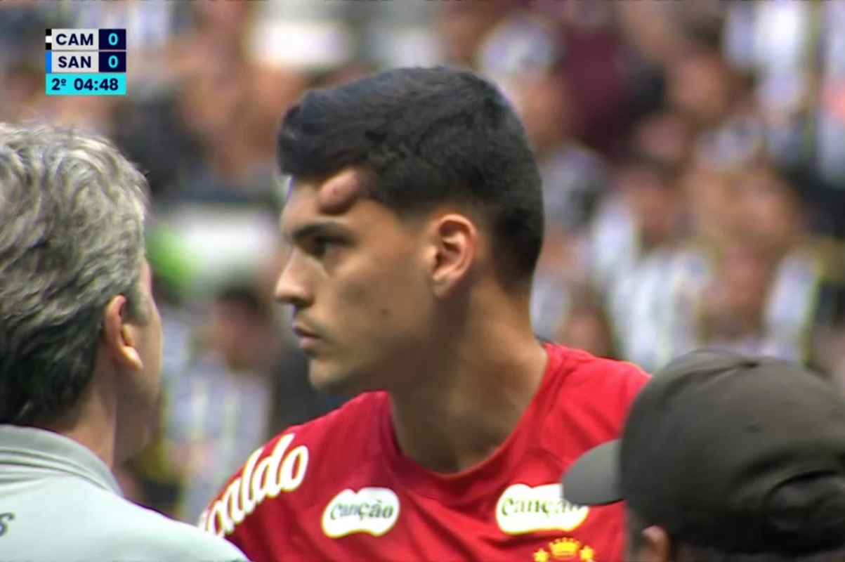 Gabriel Brazão tranquiliza após pancada na cabeça: “Só um susto”
