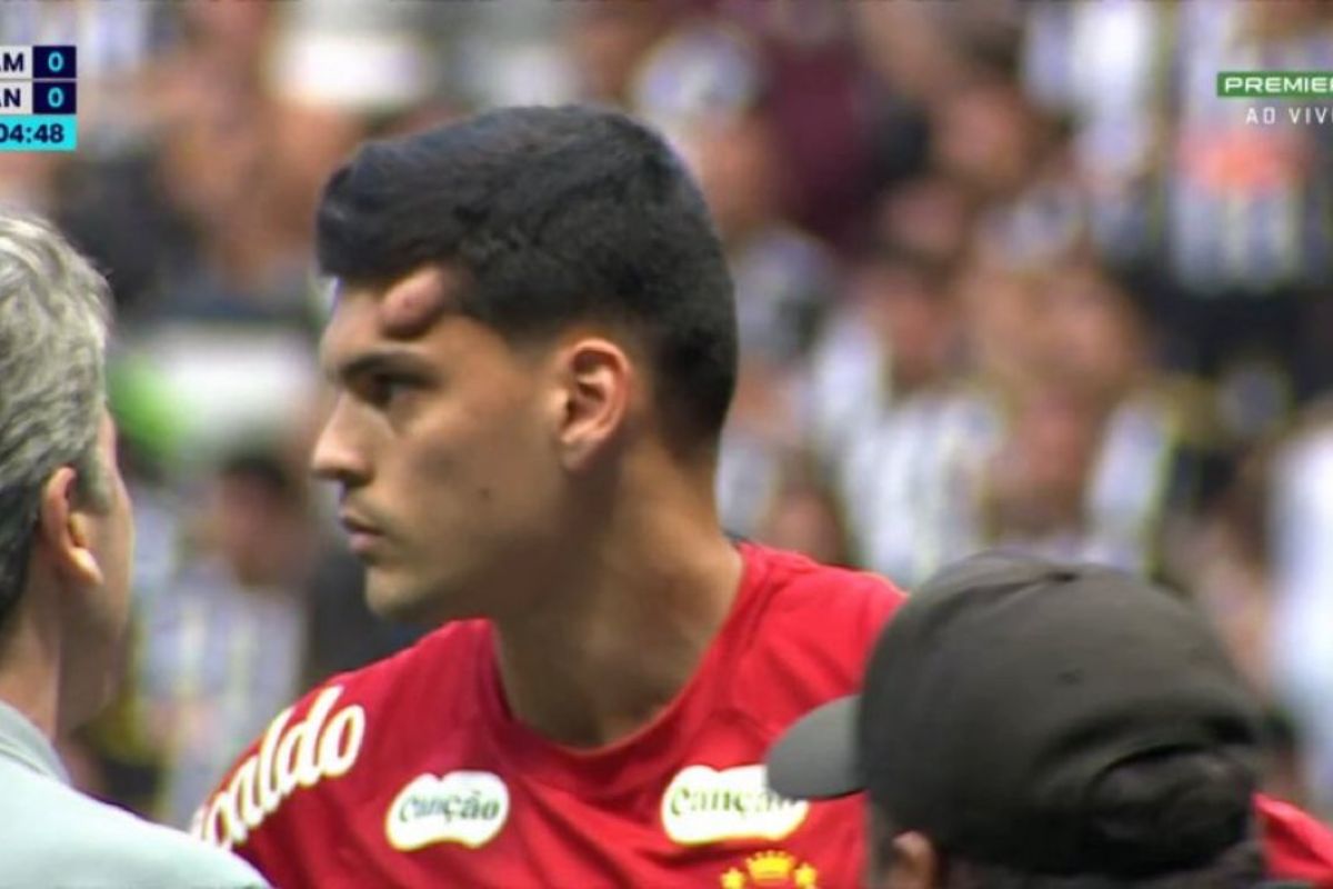 Santos atualiza quadro do goleiro Gabriel Brazão. Confira