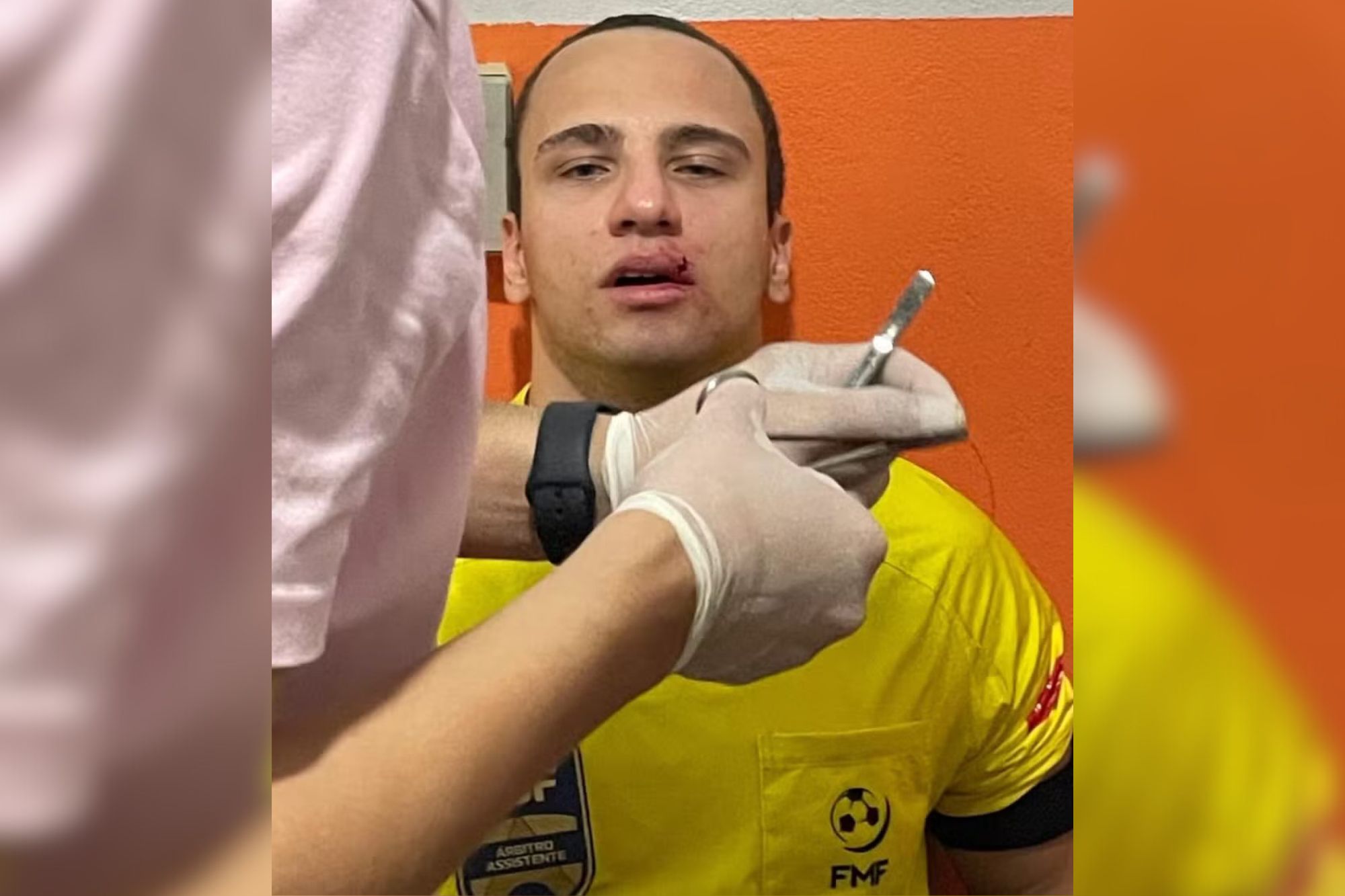Árbitro assistente é agredido em partida de futebol em Mato Grosso