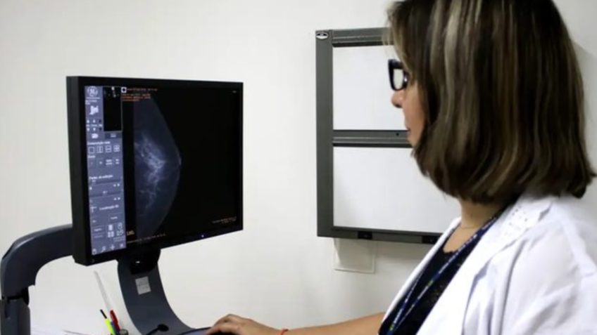 Ministério da Saúde padroniza acesso a exame de mamografia no SUS