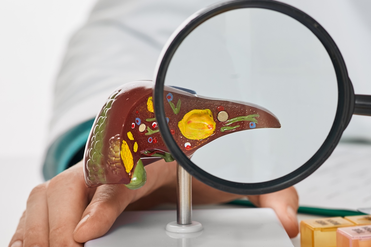 Estudo: gordura invisível no fígado afeta as artérias silenciosamente