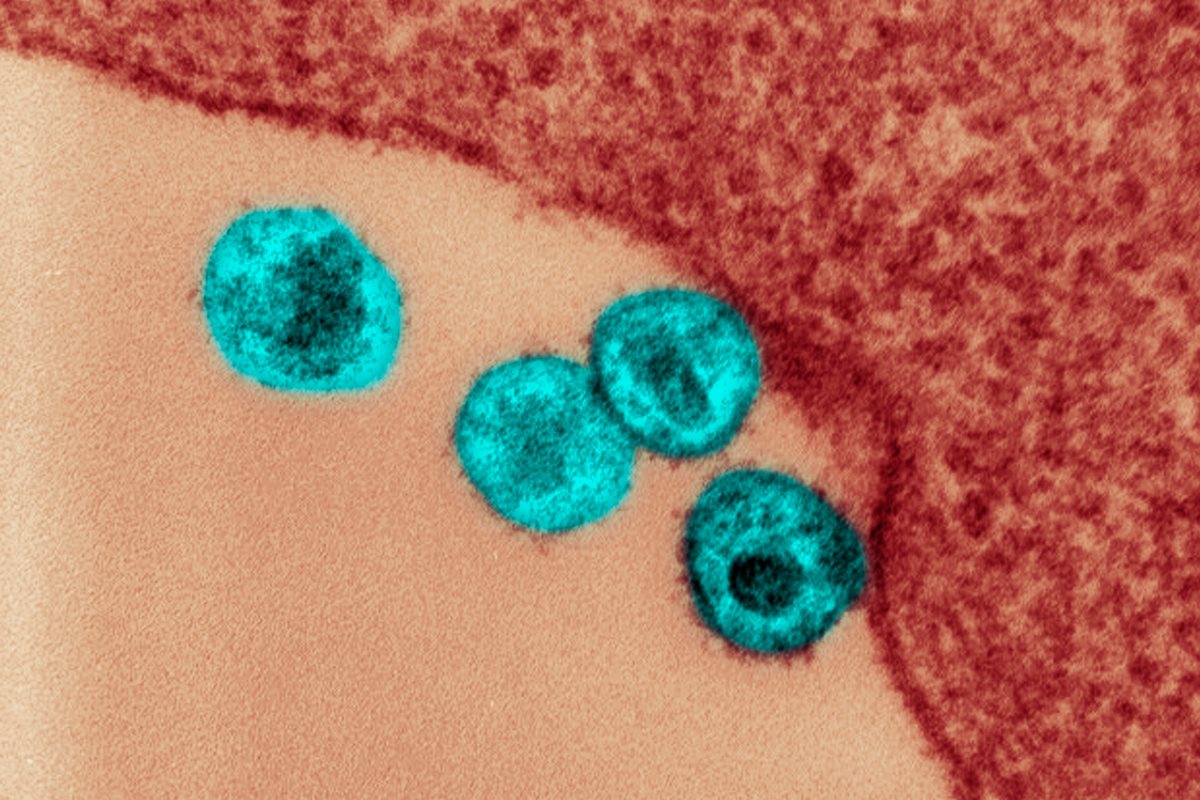 Estudo indica em quais partes do corpo o HIV se esconde