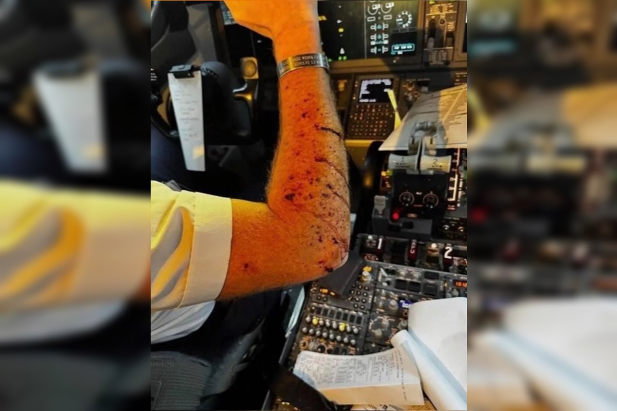 Objeto misterioso atinge avião nos EUA, fere piloto e força pouso