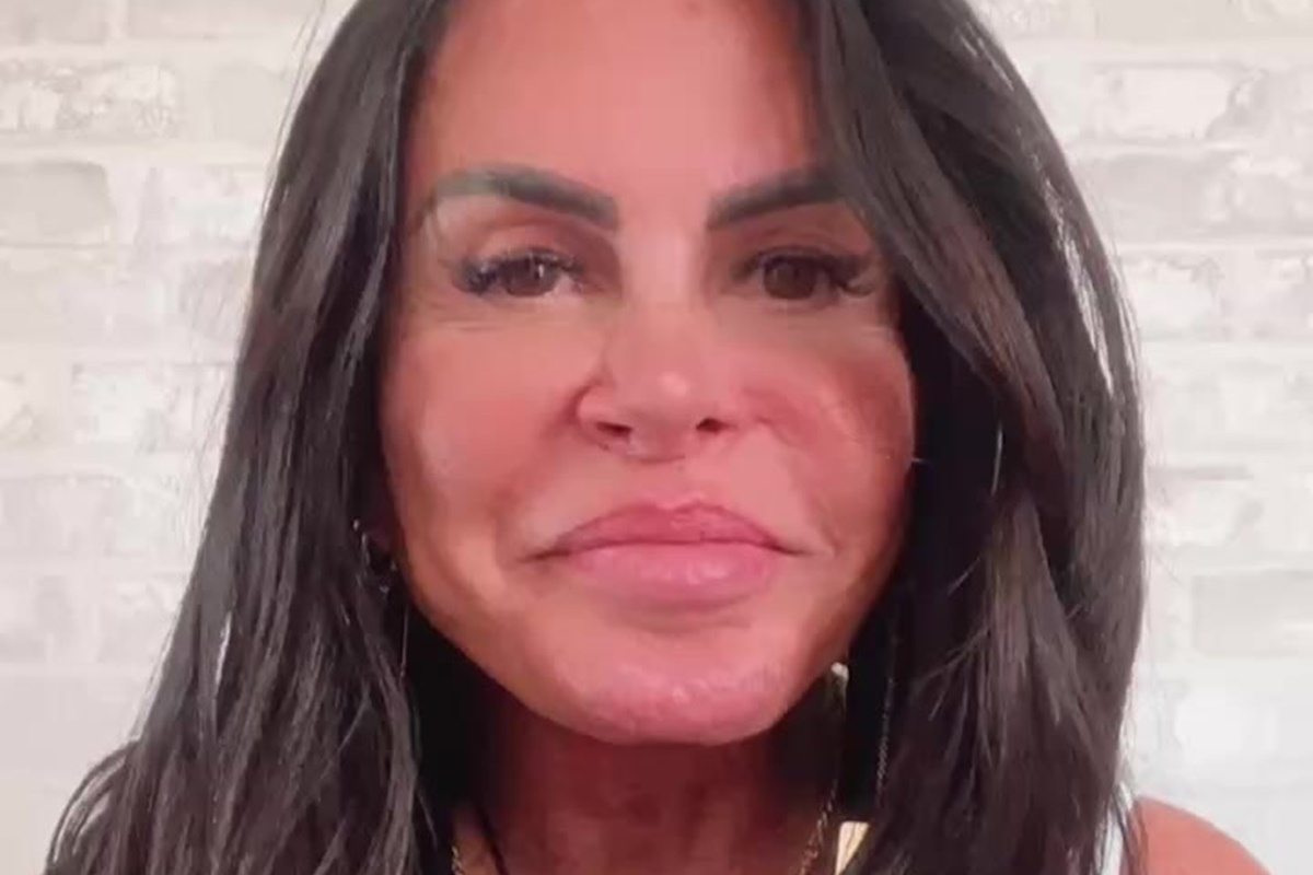 Gretchen desabafa sobre luta contra alopecia: “Não tenho mais cabelo”