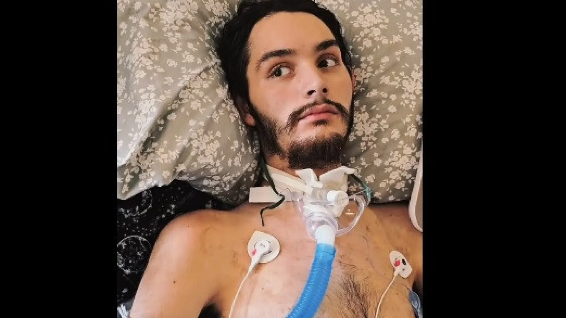 Jovem em coma acorda, denuncia namorada por acidente e morre dias depois