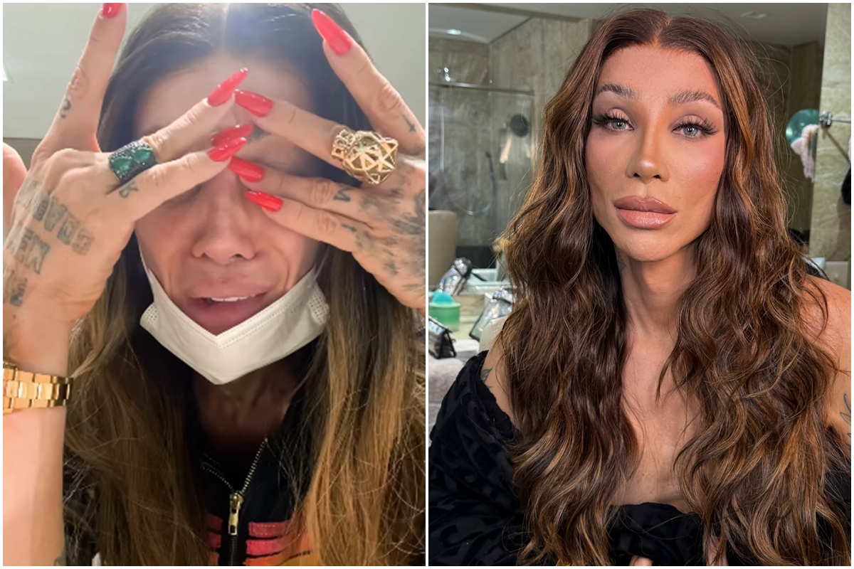 Maya Massafera tem complicações após nova cirurgia no rosto