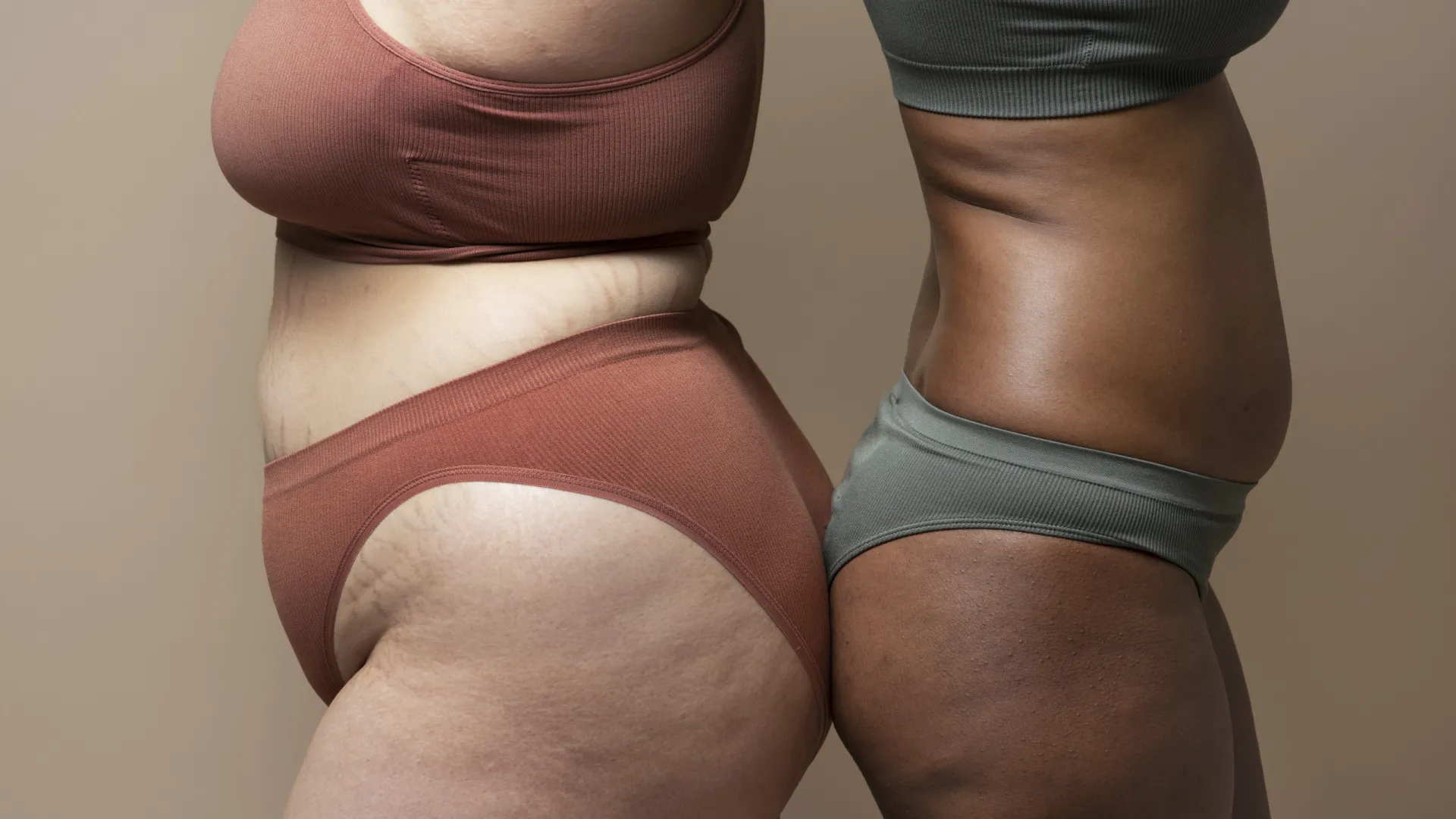 Lipedema: uma doença pouco conhecida  e com impacto significativo