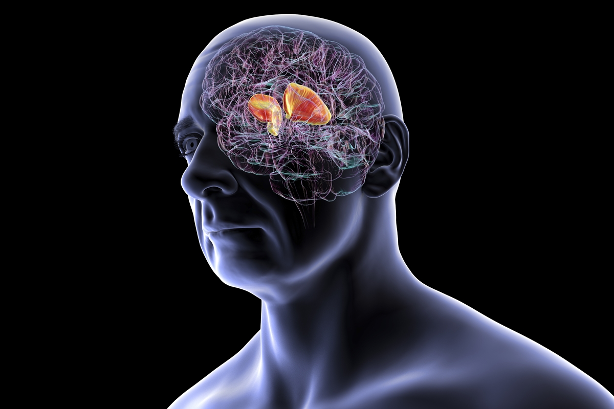 Cardiologista indica principais sintomas de AVC e como reduzir o risco