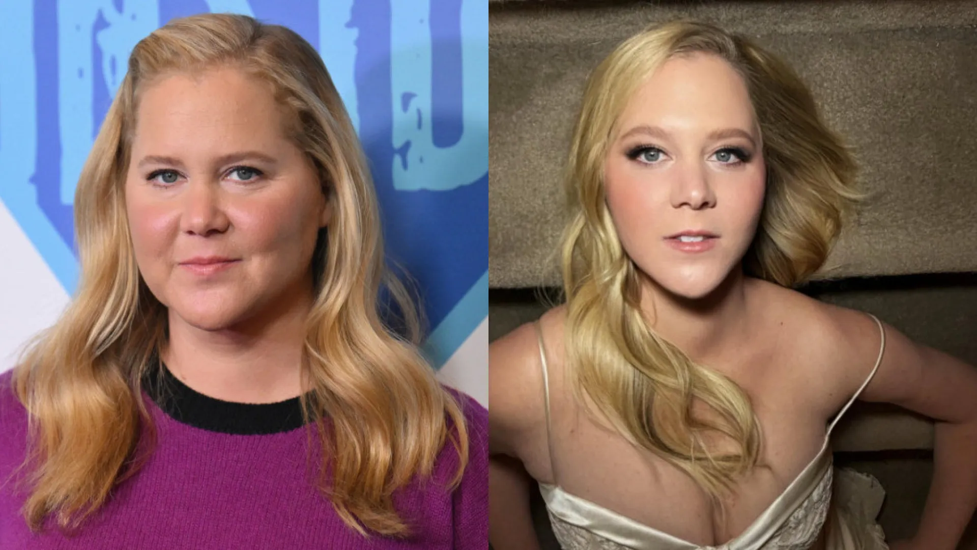 Amy Schumer perde 23 quilos e impressiona: "Fiz isto para sobreviver"