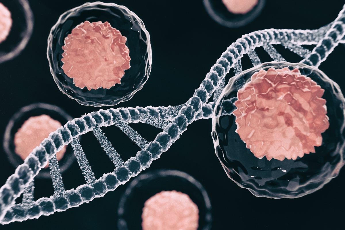 64% dos pacientes têm remissão de leucemia grave com terapia genética