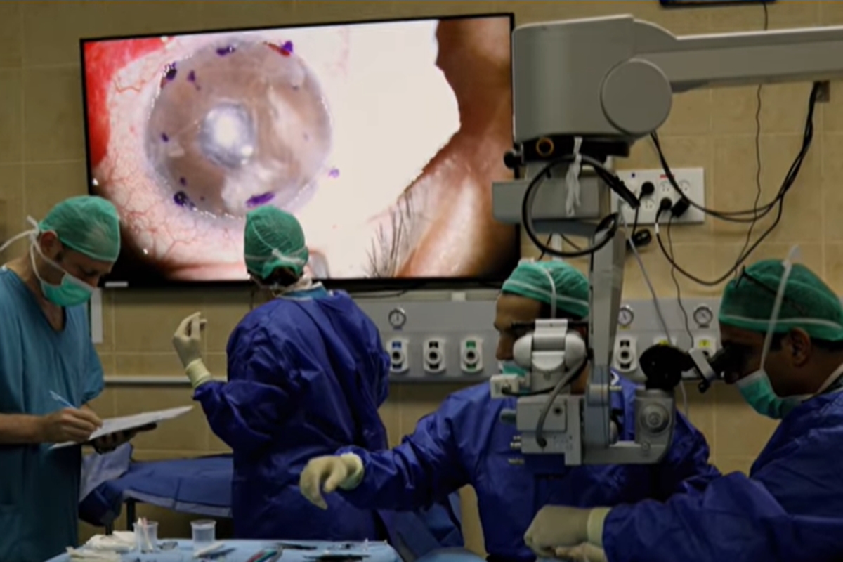 Transplante de córnea feita com impressora 3D é realizado pela 1ª vez