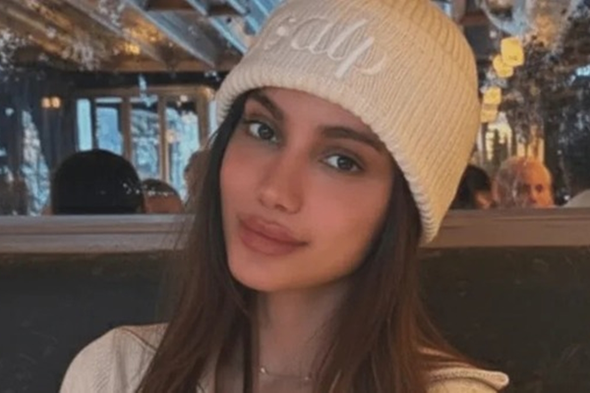 Anitta aparece com rosto diferente e web reage. Veja antes e depois