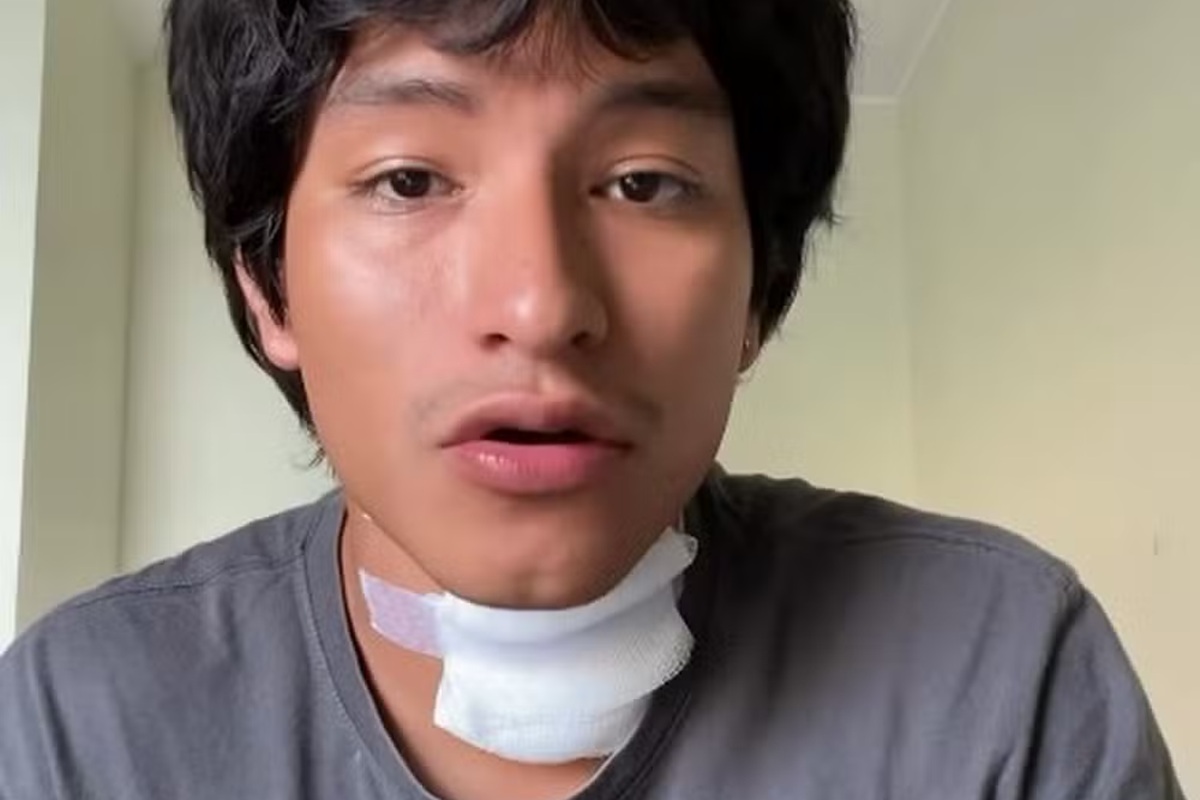 Vídeo: cantor leva choque elétrico em microfone e sofre queimaduras