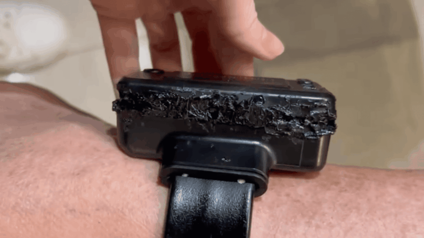 Laudo cita violação "grosseira" de tornozeleira de Bolsonaro