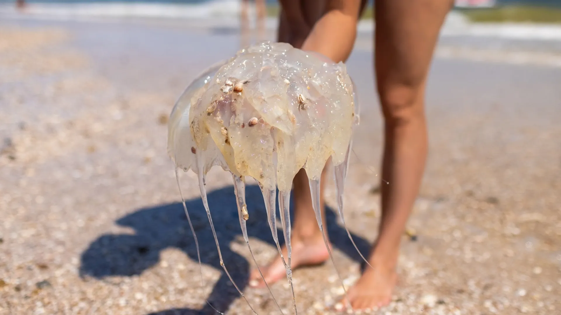 Como tratar uma queimadura de água-viva em crianças?