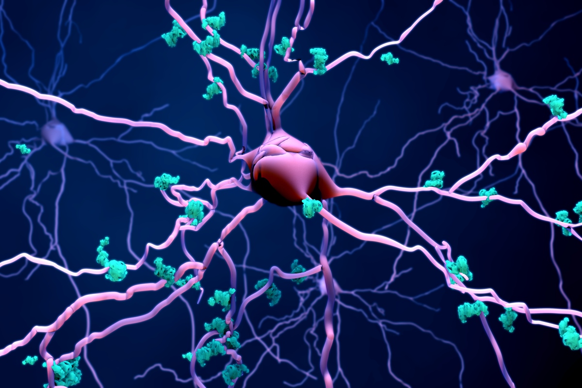 Alzheimer: medicamento pode reduzir morte de neurônios, indica estudo