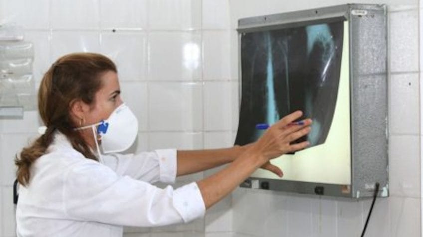 Brasil não atinge meta da OMS para reduzir tuberculose