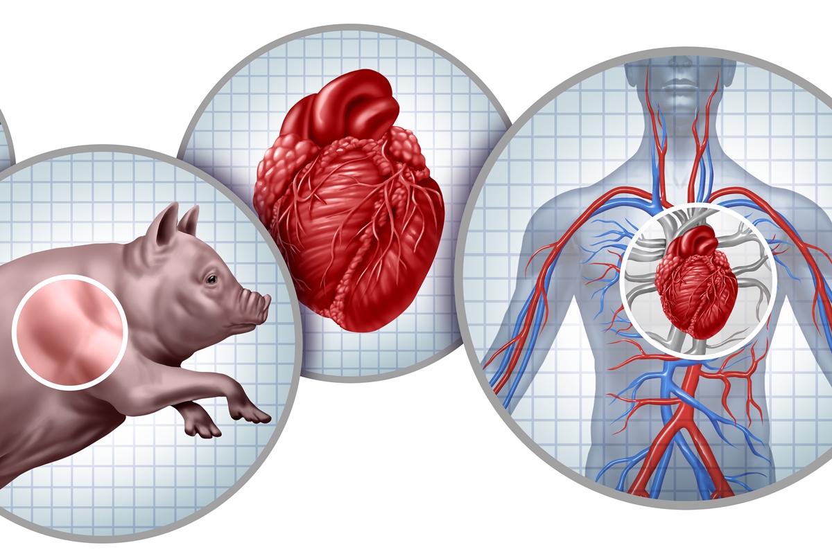 Xenotransplante: médicos dizem como técnica promissora avançou em 2025