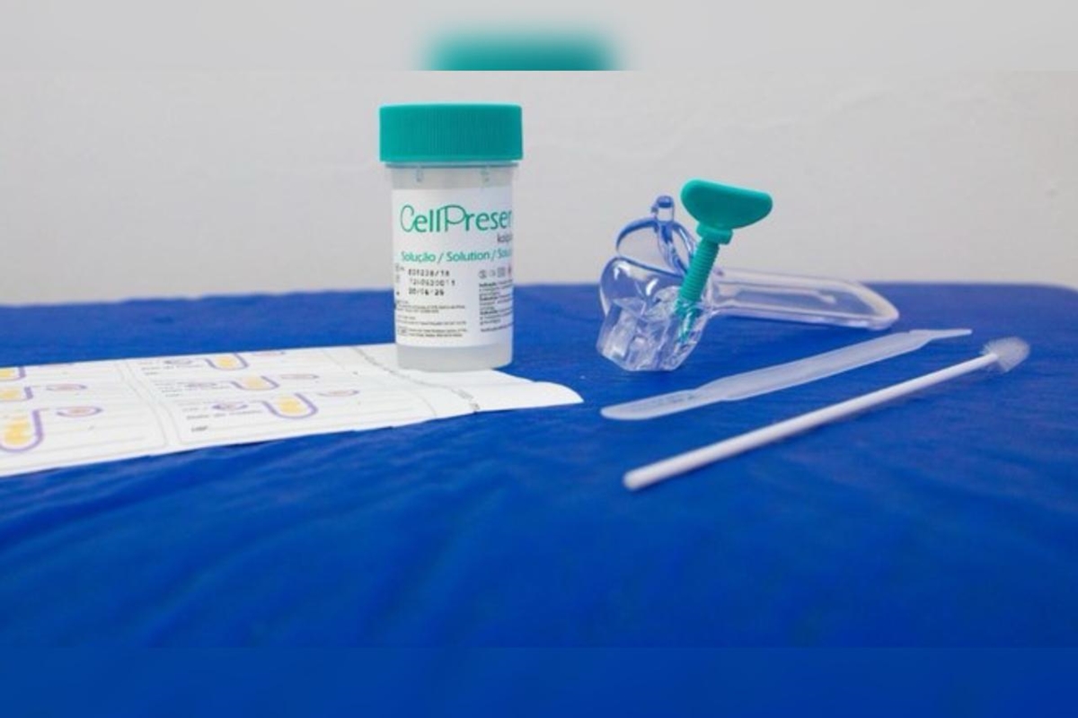 Câncer de colo do útero: novo guia orienta mudanças no papanicolau